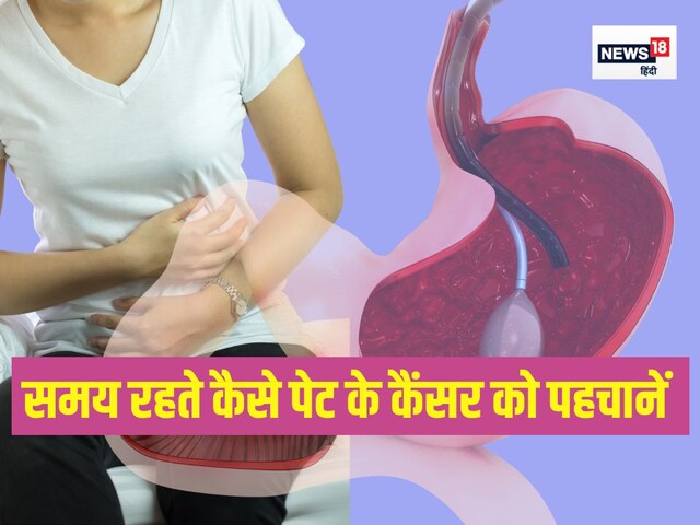 पेट का कैंसर कब होता है? कौन सी परेशानी देती है संकेत, कैसे समझें कि अब डॉक्टर