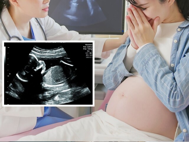 पेट में 'जुड़वां बच्चे' लेकर पैदा हुआ बच्चा, कोख से निकलते ही हुई 'डिलीवरी'!