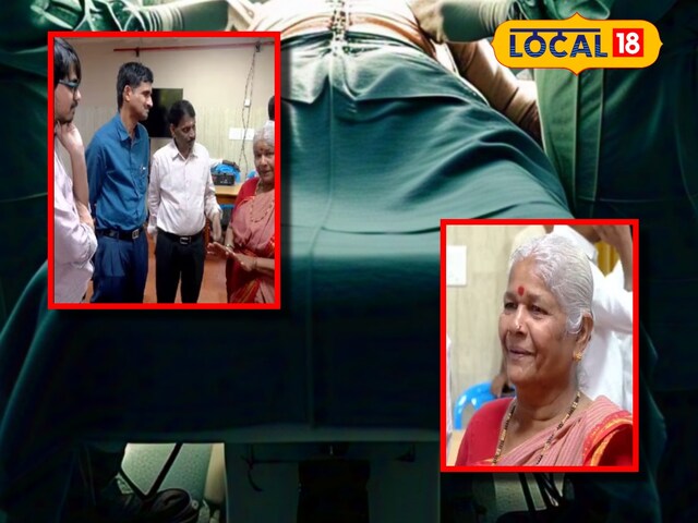 सर्जरी में 1CM की जगह में 3CM लंबी गांठ निकाली! एक दिन में ही चलने लगी बुजुर्ग सर्जरी में 1CM की जगह में 3CM लंबी गांठ निकाली! एक दिन में ही चलने लगी बुजुर्ग