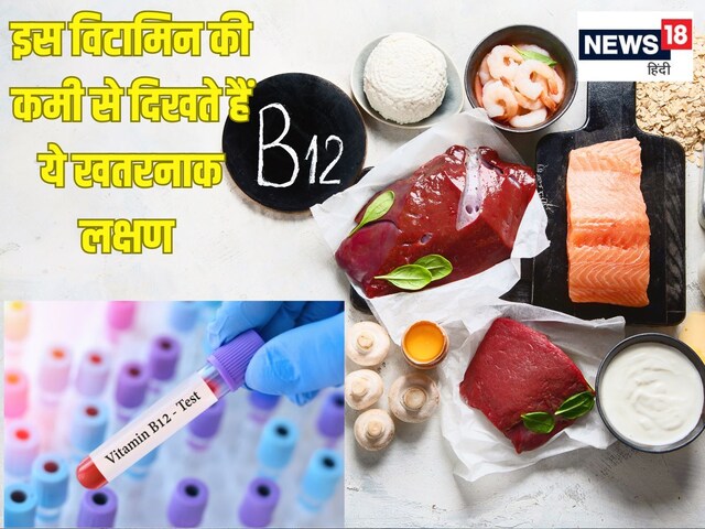 शरीर तोड़ देती है इस विटामिन की कमी, बॉडी में कम होने पर दिखते हैं ये 10 लक्षण