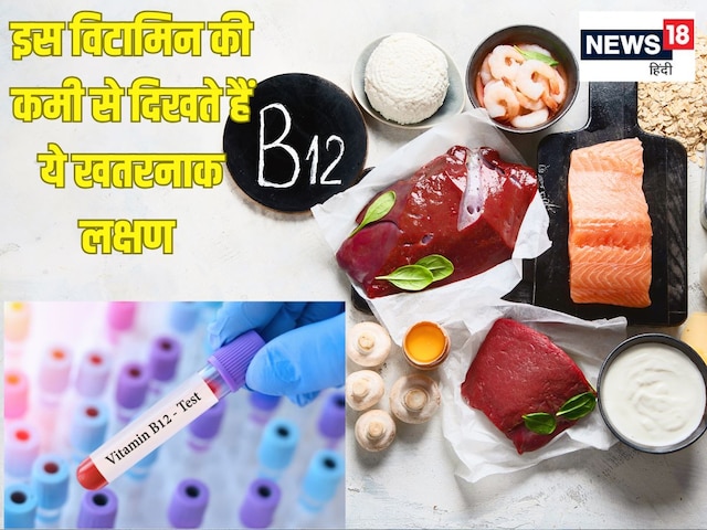 शरीर तोड़ देती है इस विटामिन की कमी, निचोड़ लेगी मांसपेशियां, बॉडी में कम होने पर दिखते हैं ये 10 खतरनाक लक्षण शरीर तोड़ देती है इस विटामिन की कमी, निचोड़ लेगी मांसपेशियां, बॉडी में कम होने पर दिखते हैं ये 10 खतरनाक लक्षण