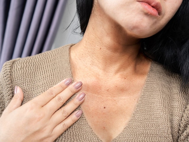 How to remove the blackness of the neck? Do these 5 easy remedies for 10 days, the effect will soon be seen!