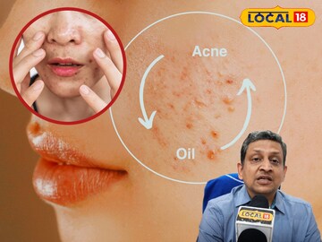 गर्मियों में चाहिए खिला-खिला चेहरा, अपनाएं ये आसान स्किन केयर टिप्स