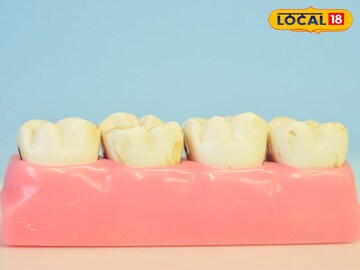 Teeth