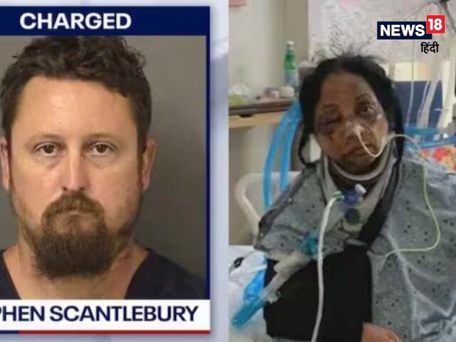 फ्लोरिडा नर्स हमला: जान तो बची लेकिन जा सकती है आंखों की रौशनी