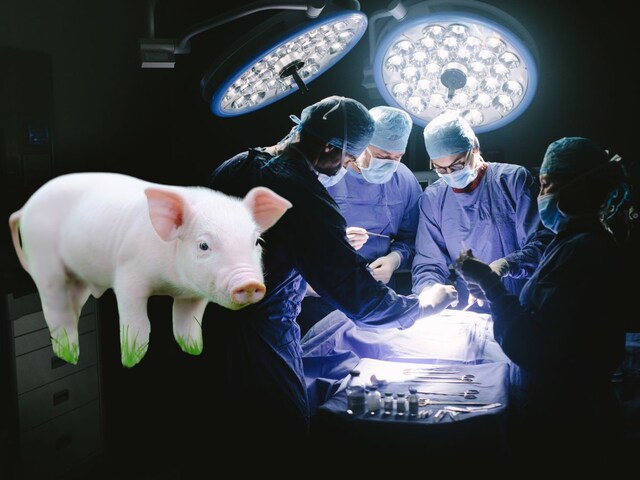 मेडिकल इतिहास का करिश्मा, पहली बार सूअर का लिवर इंसान में प्रत्यारोपित