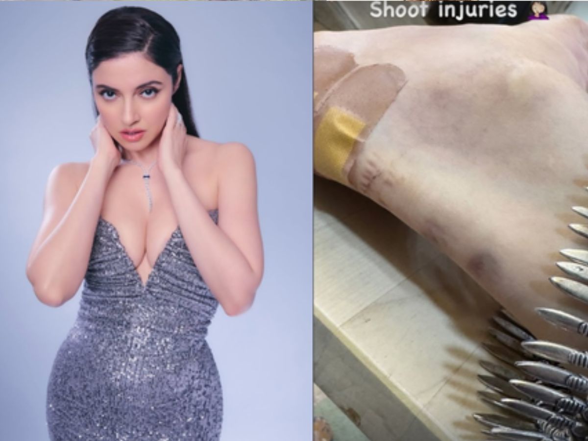 divya khosla, divya khosla, injured