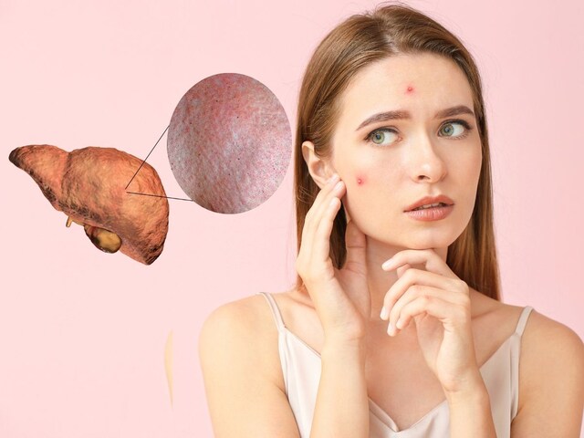 दाग-धब्बे स्किन प्रॉब्लम नहीं, इस अंग के खराब होने पर भी हो सकते हैं