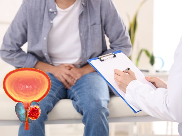 These 6 foods can beat prostate cancer, ability to stop growth immediately