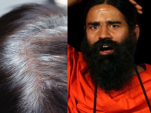 कम उम्र में बाल हो रहे हैं सफेद? बाबा रामदेव ने बताए 5 आसान तरीके, सफेद बाल भी हो जाएंगे काले ! कम उम्र में बाल हो रहे हैं सफेद? बाबा रामदेव ने बताए 5 आसान तरीके, सफेद बाल भी हो जाएंगे काले !