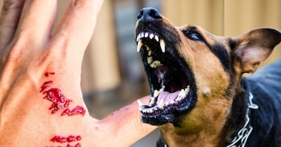 सतना में पागल कुत्ते का कहर