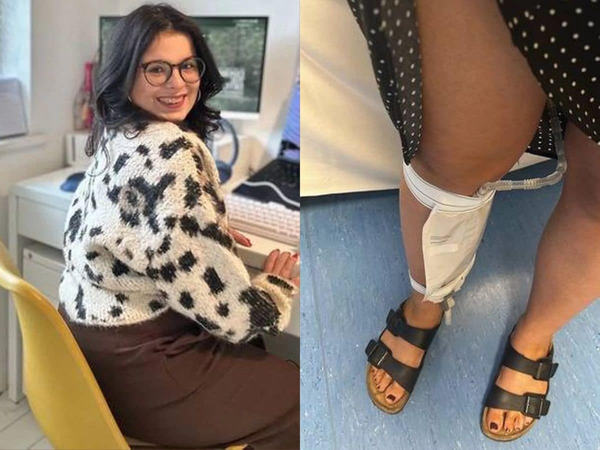 Fowler-Syndrome-Greggs-Store-Disabled-Toilet-Catheter-Bag-Invisible-Disability-Urinary-Condition-2025-04-d62528ba1ddeebc6a4d82f1638604098 The woman who went to the toilet of the disabled due to rare disease, stopped the staff, then ...