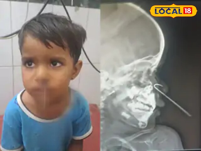 बच्ची