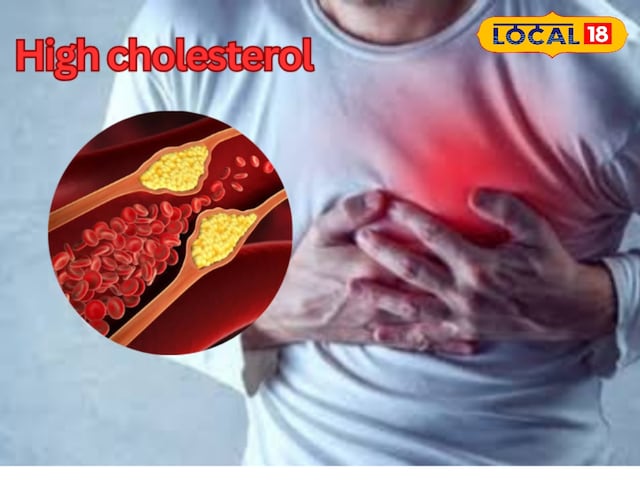 Heart will spoil high cholesterol, learn home remedy to control Heart will spoil high cholesterol, learn home remedy to control