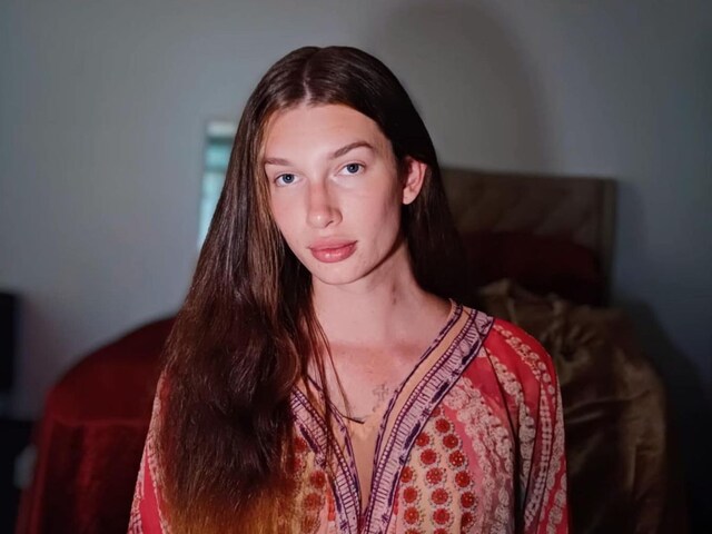 Jolene-Dawson-001-insta-2025-04-5d0b78f8c891a9ad96647e22e892682d Millions spent to look like a cat, now this social media star is regretting!