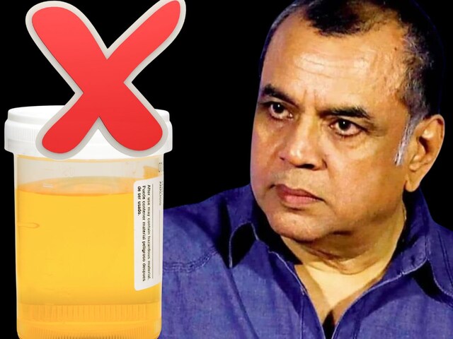 परेश रावल की हड्डी क्या सच में पेशाब पीने से जुड़ गई? किडनी के डॉक्टर ने खोली पोल, जान लीजिए सच्चाई