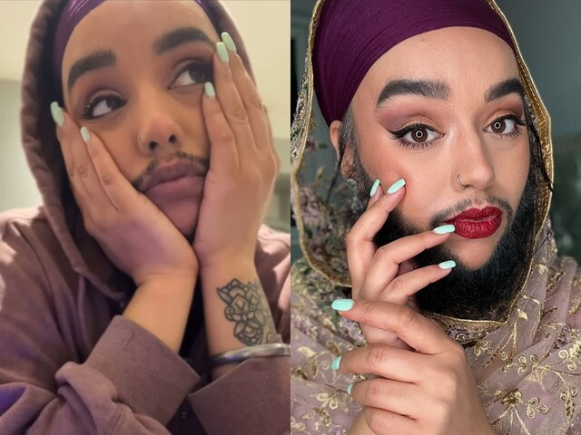 Learn why women grow on the face of women?