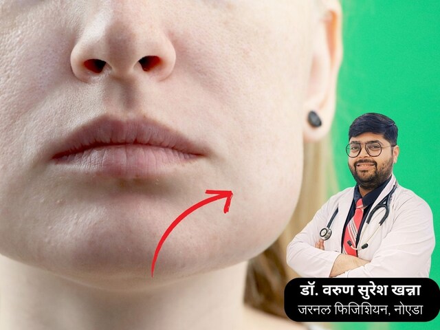 Why does swelling come on the face? It is not a symptom of a serious illness