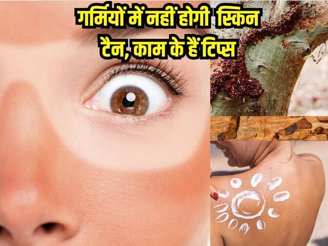 गर्मी में स्किन टैन से बचने के 5 सस्ते उपाय गर्मी में स्किन टैन से बचने के 5 सस्ते उपाय