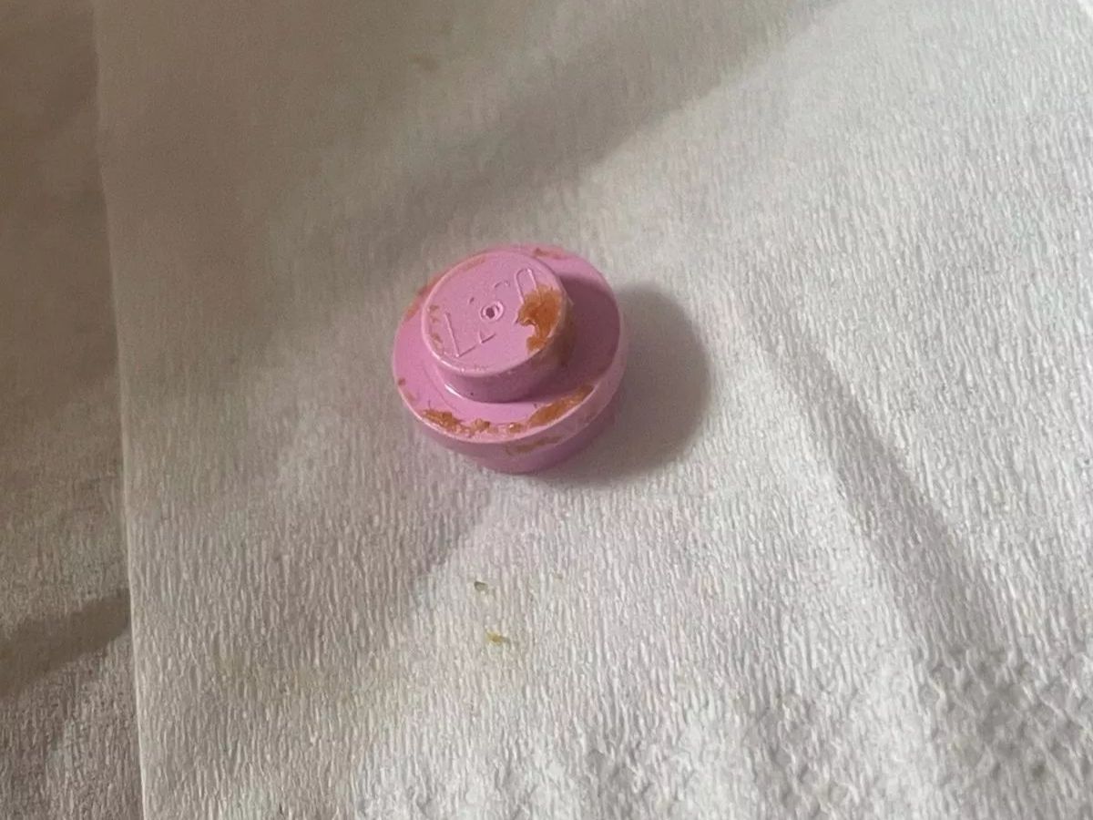 toy-stuck-in-year-1-2025-04-b486b97e491b30abbb2390ffff6606a0 Man Thought He is Getting Deaf Found Toy Stuck in Boy Ear from 20 Years Scotland Bizarre News | There used to be terrible pain in the boy's ear, not even the benefit of medicine, such a thing came out one day, flew away after seeing!