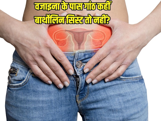 Women Health: Lump in vagina, not bartholin cyst? Symptoms look like this Women Health: Lump in vagina, not bartholin cyst? Symptoms look like this