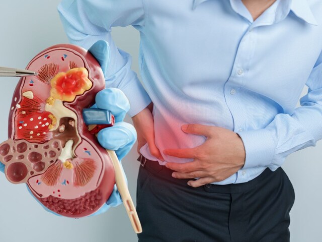 ज्यादा कोल्ड ड्रिंक पीने वाले सावधान! ब्लैडर में हो सकती है स्टोन की भरमार