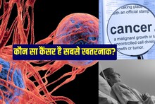 Cancer symptoms: 50 साल से कम उम्र में बढ़े कैंसर के मामले, जानें खतरनाक लक्षण