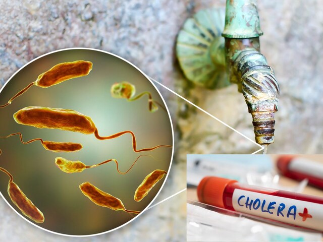 Increase in cholera cases in Sudan, 2,729 new cases in Khartum