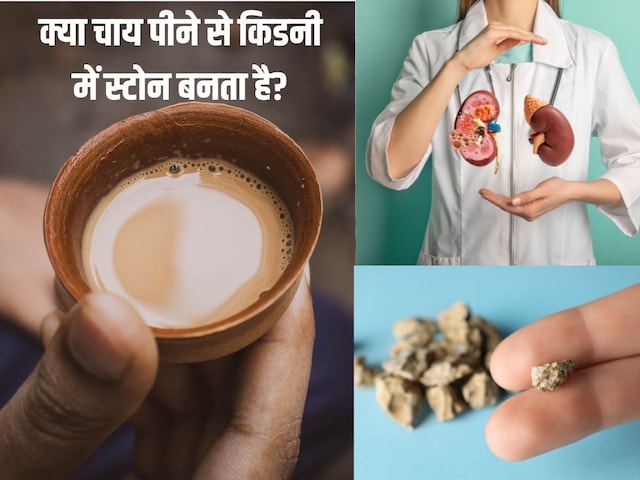 क्या चाय पीने से किडनी में स्टोन बनता है? क्या ये मिथ है, जानें यहां इस बात में कितनी है सच्चाई