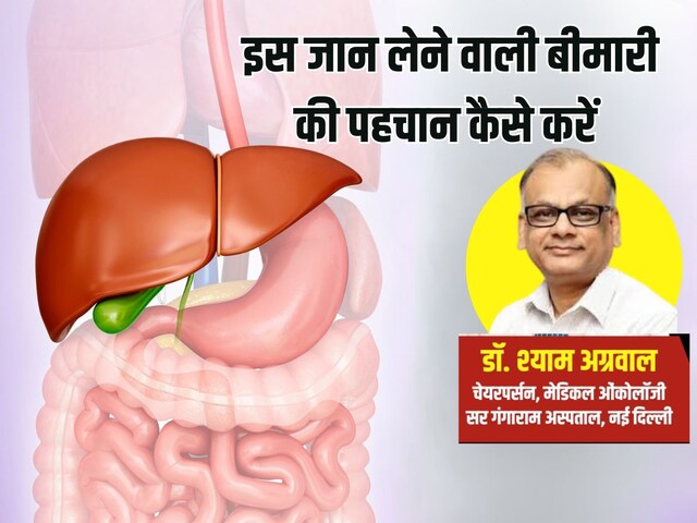 अचानक मौत लेकर आती है यह बीमारी, नहीं दिखते लक्षण, पहले पता लगाने का क्या है तरीका, डॉक्टर ने दिए टिप्स