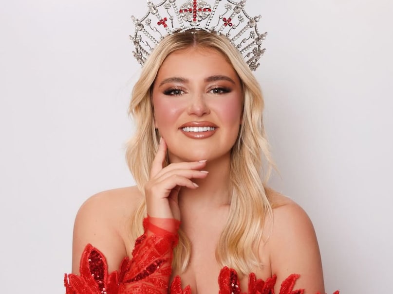 Miss World Controversy, Miss England, Milla Magee, Beauty Pageant Exploitation, Beauty Pageant Criticicism, Milla Magee Alleagation Against Miss World Controversy Miss World Controversy, Miss England, Milla Magee, Beauty Pageant Exploitation, Beauty Pageant Criticicism, Milla Magee Alleagation Against Miss World Controversy