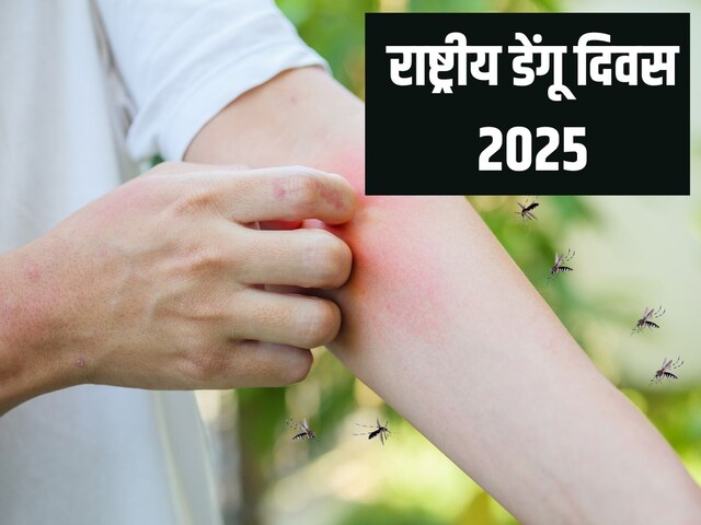 National Dengue Day 2025: Dengue season is coming, prepare for rescue now