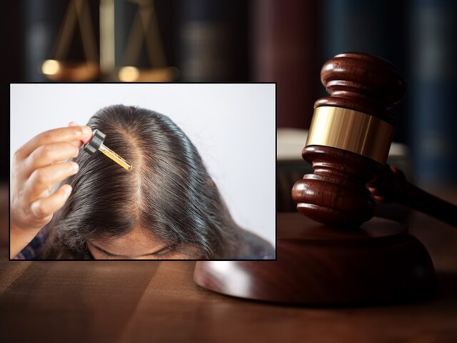 70 लोगों को अस्पताल पहुंचाने वाला हेयर ऑयल इंफ्लुएंसर! बाल नहीं आए तो जेल