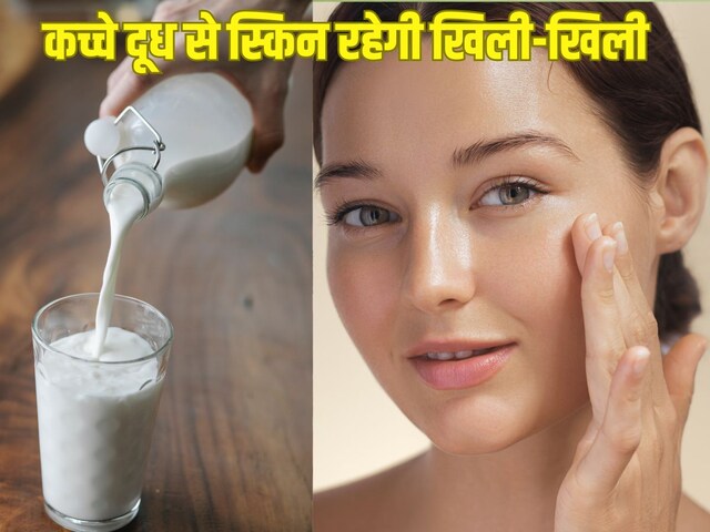 How Raw milk Good for skin: गर्मियों में त्वचा पर लगाएं कच्चा दूध, होंगे फायदे