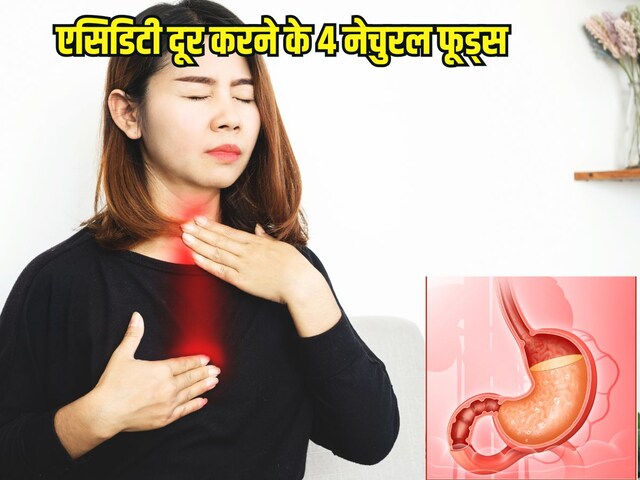 Natural remedies for acidity: गर्मी में एसिडिटी की समस्या सताए, दूर करने के लिए खाएं 4 नेचुरल फूड्स