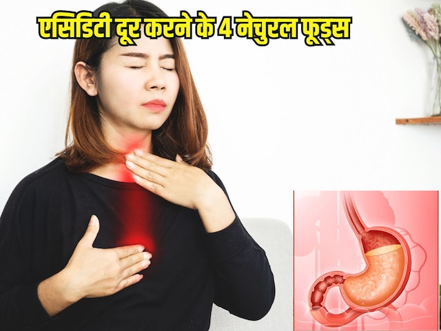 Natural remedies for acidity: गर्मी में एसिडिटी की समस्या सताए, दूर करने के लिए खाएं 4 नेचुरल फूड्स Natural remedies for acidity: गर्मी में एसिडिटी की समस्या सताए, दूर करने के लिए खाएं 4 नेचुरल फूड्स