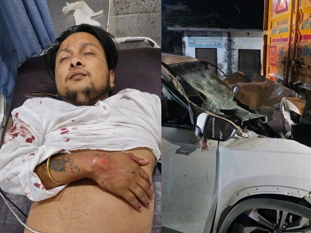Indian Idol winner singer Pawandeep injured in major car accident delhi  referred : इंडियन आइडल विजेता पवनदीप की गाड़ी का भीषण हादसा, गंभीर रूप से  घायल - News18 हिंदी