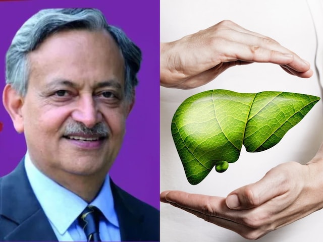 आपका लिवर हो रहा डैमेज? बिना टेस्ट के ऐसे लगाएं पता, डॉक्टर सरीन ने बताए टिप्स आपका लिवर हो रहा डैमेज? बिना टेस्ट के ऐसे लगाएं पता, डॉक्टर सरीन ने बताए टिप्स