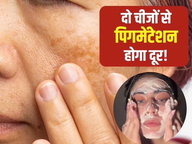 उम्र बढ़ने के साथ चेहरे पर बढ़ता जा रहा है पिगमेंटेशन? 2 चीजों से करें दूर