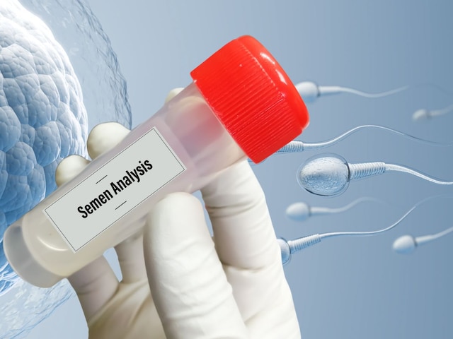 सिर्फ 5 मिनट में घर बैठे चेक करें स्पर्म काउंट ! जान लें आसान तरीका सिर्फ 5 मिनट में घर बैठे चेक करें स्पर्म काउंट ! जान लें आसान तरीका