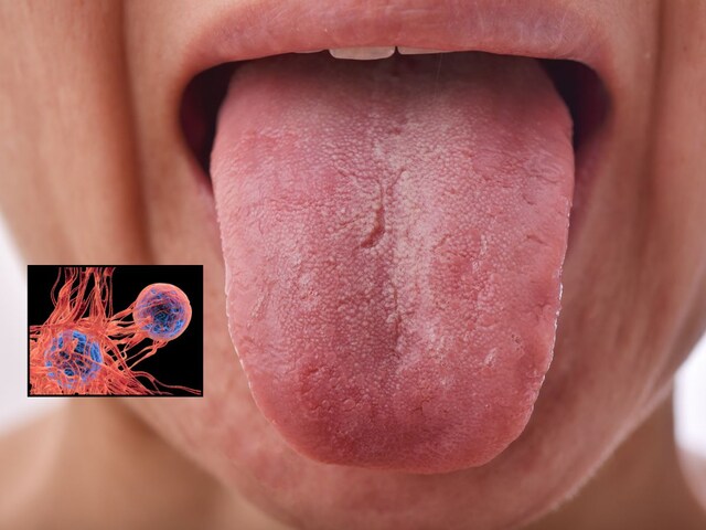 Looking at the tongue, find out what the disease you have? Know how to check