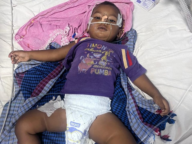 11 महीने की बच्ची को करैत सांप ने काटा, 97 घंटे तक वेंटिलेटर पर रखा, फिर..