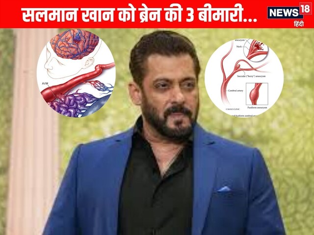 Salman Khan has 3 diseases of the brain, you are not hunting anywhere, know