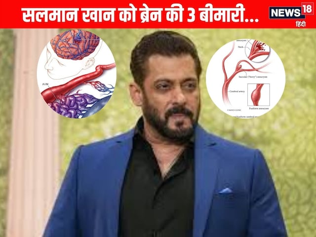 Salman Khan has 3 diseases of the brain, you are not hunting anywhere, know Salman Khan has 3 diseases of the brain, you are not hunting anywhere, know