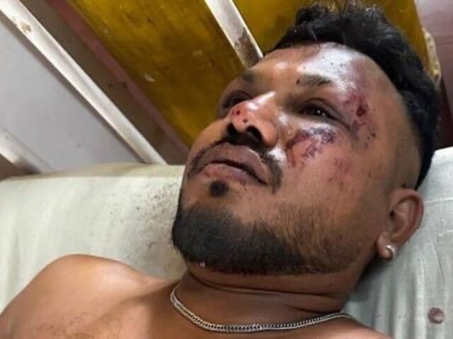 जाको राखे साइयां... अहमदाबाद प्लेन क्रैश में जिंदा बचे विश्वाश कुमार रमेश