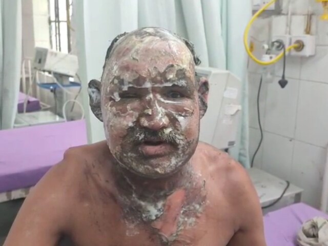 बेटी -इन -इन ने अपने पिता को बनाया था, जो आग का शिकार हुआ, खाने के लिए तर्क के बाद एक भयानक घटना!