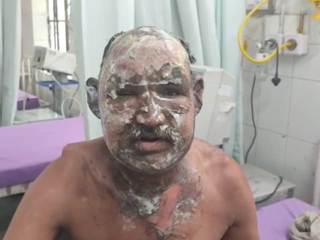 बेटी -इन -इन ने अपने पिता को बनाया था, जो आग का शिकार हुआ, खाने के लिए तर्क के बाद एक भयानक घटना! बेटी -इन -इन ने अपने पिता को बनाया था, जो आग का शिकार हुआ, खाने के लिए तर्क के बाद एक भयानक घटना!