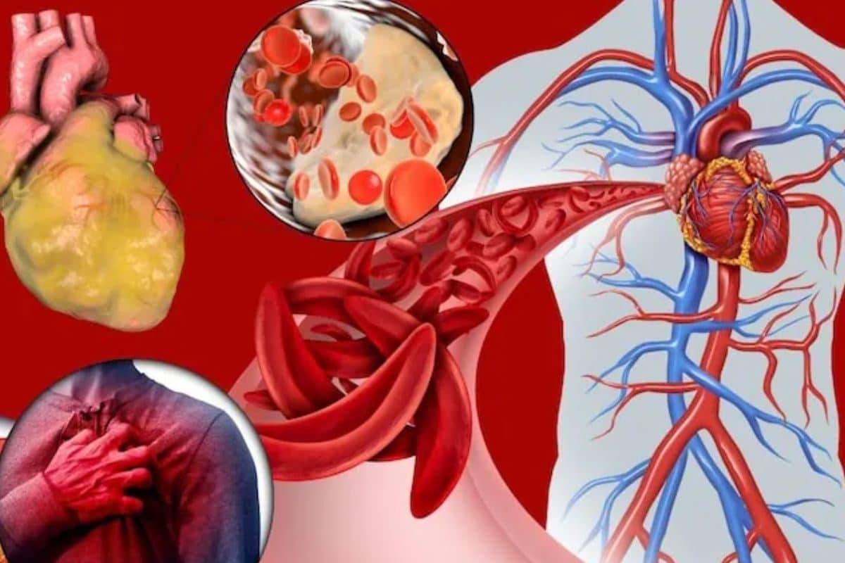 Heart Blockage: ये 5 लक्षण बताते हैं कि आपका हार्ट सही से काम नहीं कर रहा