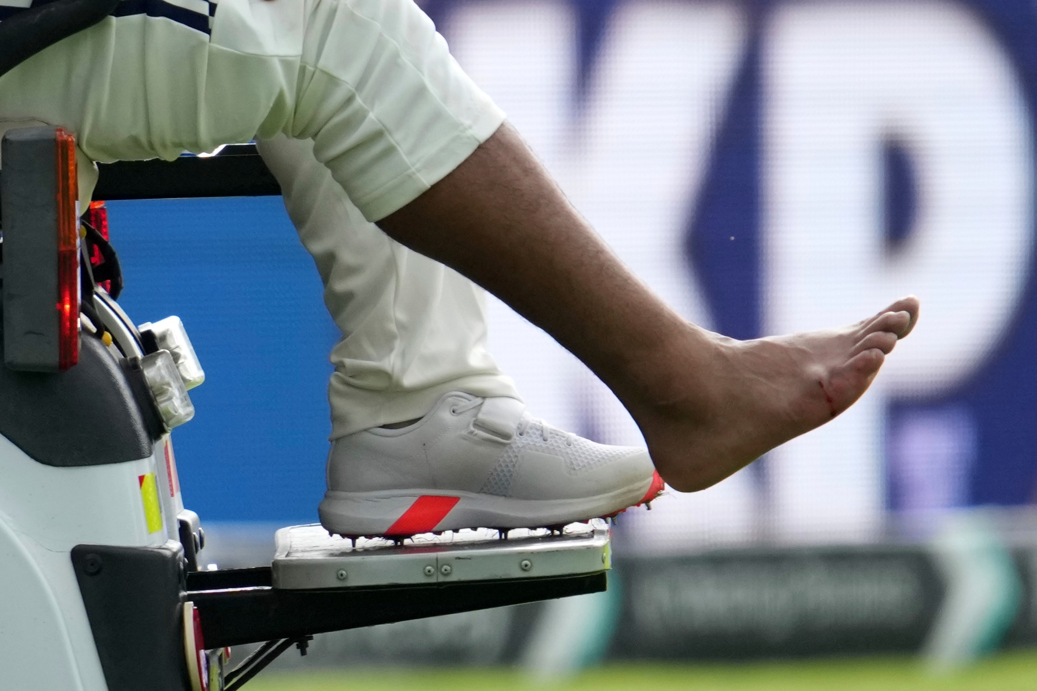 Rishabh Pant Foot Injury Updates, Rishabh Pant Injury Update, Rishabh Pant Injury, Rishabh Pant Replacement, Ind vs Eng, India vs England, India Tour of England, Rishabh Pant Injury Latest Update, Concussion Rule, Concussion Substitute, Rishabh Pant, Rishabh Pant Hurt, Rishabh Pant Update 