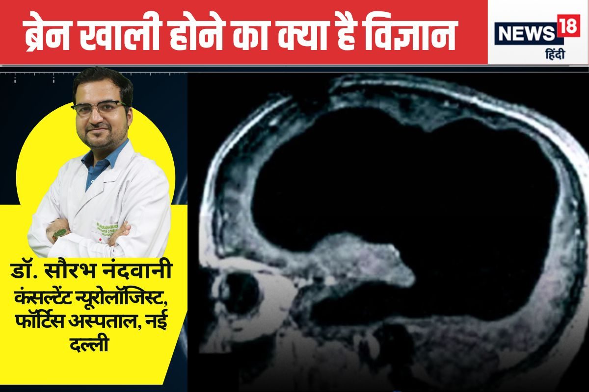 क्या कुछ लोगों का दिमाग सच में खाली होता है? ब्रेन स्कैन से डॉक्टर भी अचंभित
